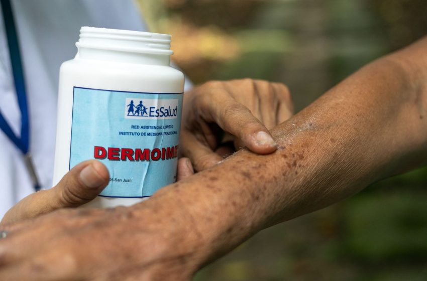  EsSalud: conoce la pomada hecha de plantas medicinales que cura problemas de la piel