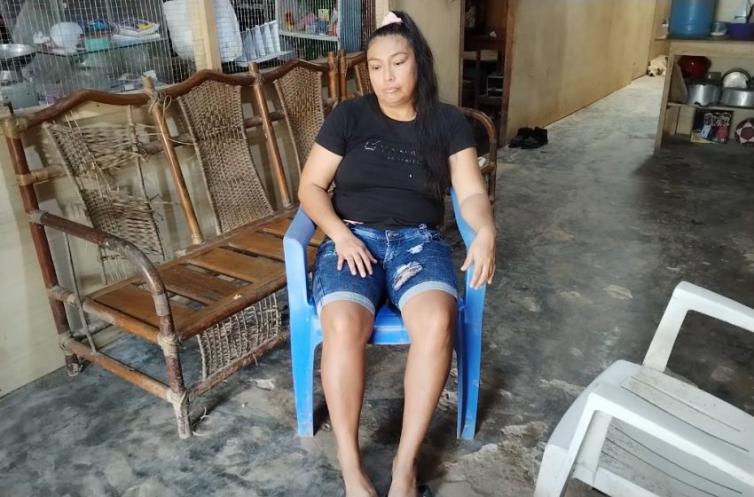  Loreto: especialistas diagnostican rara enfermedad en mujer que suda sangre por diferentes partes del cuerpo